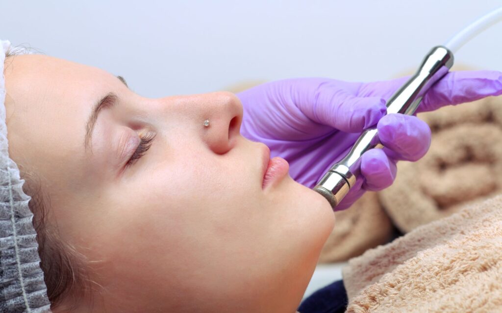 What to Expect During and After Microdermabrasion: