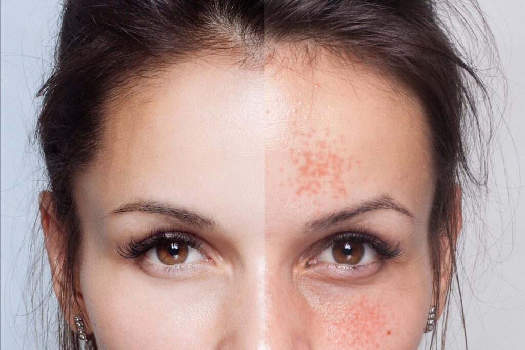 Persistent Pigmentation Spots? Discover the Supplement That Works Where Treatments Fail!